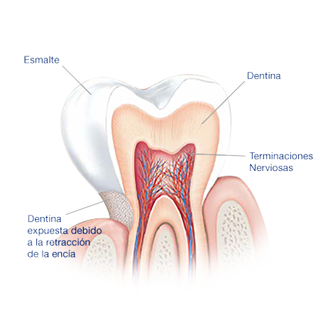 ¿Qué causa la sensibilidad dental? Partes del diente